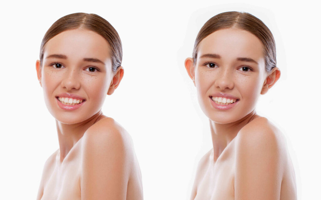 Ωτοπλαστική – Αποκαταστήστε το σχήμα των αυτιών με φυσικότητα και διακριτικότητα Ωτοπλαστική – Αποκαταστήστε το σχήμα των αυτιών με φυσικότητα και διακριτικότητα